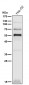 Anti-PPAR gamma Rabbit Monoclonal Antibody